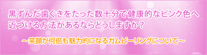 笑顔が何倍も魅力的になるガムピーリングについて